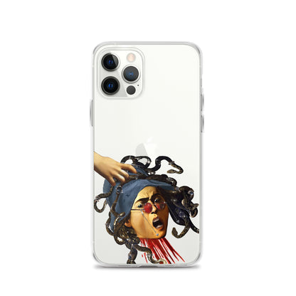 Medusa by Caravaggio x Art History Student Clear iPhone® Case