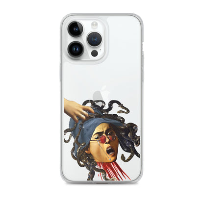 Medusa by Caravaggio x Art History Student Clear iPhone® Case